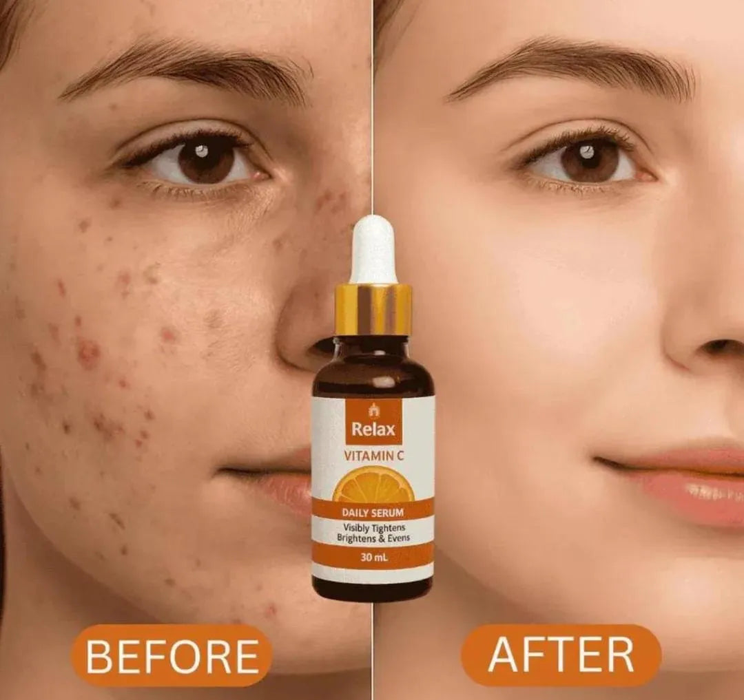 Relax Vitamin C Daily Face Serum for Skin Brightening & Dark Spot Removal - 30ml